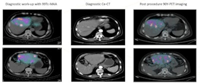 2017 04 11 12 26 17 387 2017 04 12 Chiti Fig2 350