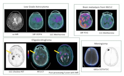 2017 04 11 12 26 18 533 2017 04 12 Chiti Fig1 350
