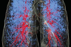 2017 04 17 12 25 11 17 Case1 Aunt Minnie 20170417192558