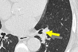 2017 04 19 10 09 33 239 2017 04 19 Italung Thumb