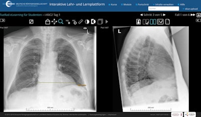 TueRad e-learning on the DRG platform. All images courtesy of the DRG.