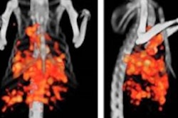 2017 05 11 11 11 06 448 Spect Ct Colorectal Jnm 200