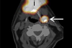 2017 05 18 09 30 59 711 2017 05 18 Ame Mol Insider Spect Ct Thumb