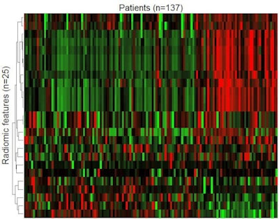 Figure 2. The machine-learning process selects a limited quantity of key features from many hundreds of parameters, and uses these to create the final radiomic signature. In figure 1, 25 parameters are arranged in order of their importance in the model.