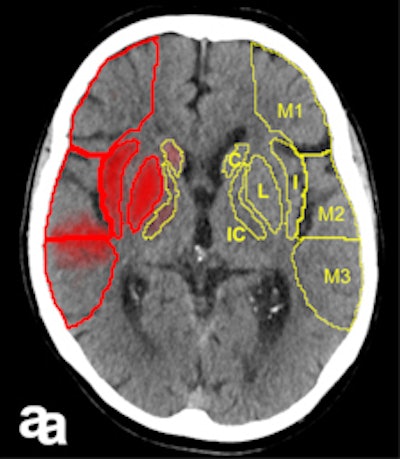 2017 05 25 09 15 42 678 2017 05 25 Stroke Herweh 2a 225