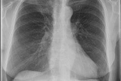 2017 05 25 13 55 00 41 2017 05 25 Copd Thumb