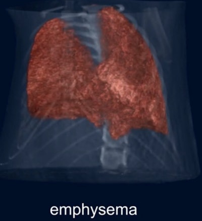 These images demonstrate phase-contrast on a mouse with emphysema (above) and fibrosis (below).