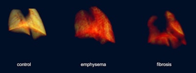 These images show the difference between a mouse control, emphysema, and fibrosis.