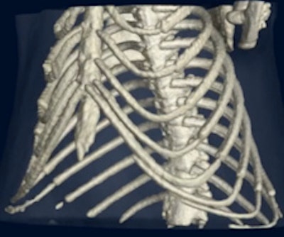 phase-contrast mouse