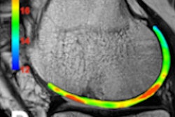 2017 06 02 11 54 34 735 2017 06 05 Mri Thumb