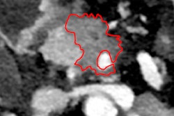 2017 06 05 12 51 39 512 2017 06 06 Ct Roeko Thumb