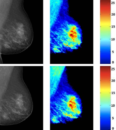 Reacquired mammograms of the same patient and their corresponding breast density maps from Volpara. The amount of breast tissue is shown in a color map along with their label in millimeters. All images courtesy of Oliver Diaz, PhD.