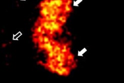 2017 06 08 11 20 43 43 2017 06 12 Cli Image Jnm Thumb