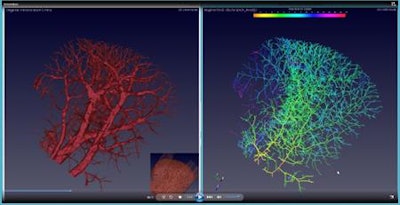 Comparison of the enhanced blood vessel prior to (left) and after the end-point skeletonization process (right).