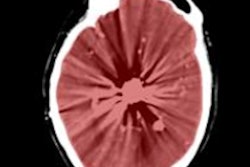 2017 06 13 10 10 07 362 2017 06 13 Ct Head Thumb