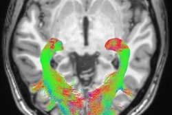 2017 07 13 11 16 52 271 2017 07 11 Mri Parkinsons Image 20170713181742