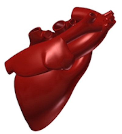 2017 07 27 11 32 37 967 2017 07 28 Ct Scan Heart 1 180