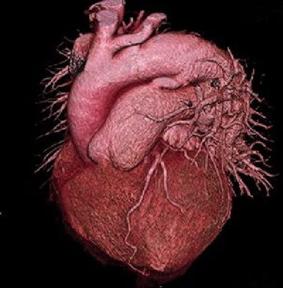 CT angiography of the heart in a 53-year-old patient with shortness of breath