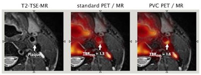 2017 09 18 19 31 6848 2017 09 19 Beyer Pic1 850 20170919155343