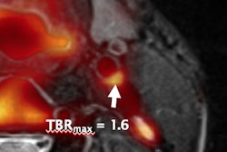 2017 09 18 19 31 7317 2017 09 19 Beyer Thumb