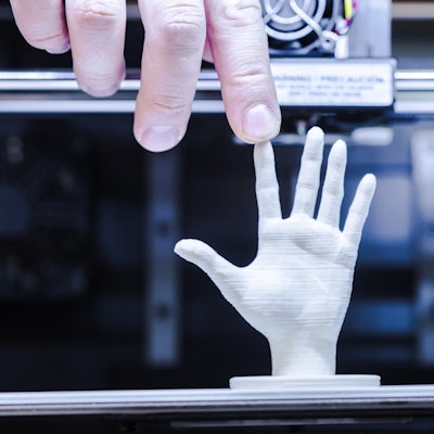 2017 09 21 16 19 8287 3 D Printing Hand Half 400