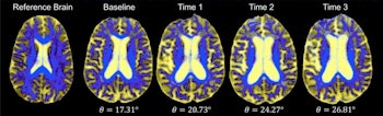 2017 09 21 19 31 6101 2017 09 22 Gp Neuro1 350