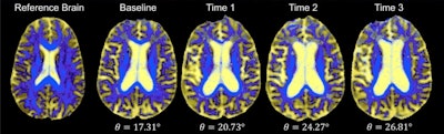 2017 09 21 19 31 6414 2017 09 22 Gp Neuro1 719