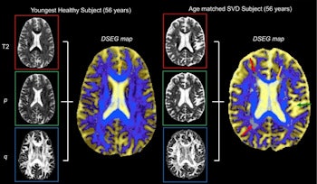 2017 09 21 19 31 6570 2017 09 22 Gp Neuro2 350