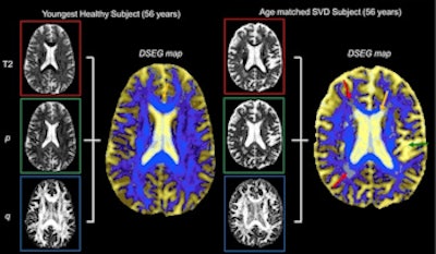 2017 09 21 19 31 6570 2017 09 22 Gp Neuro2 350