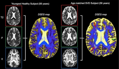 2017 09 21 19 31 6726 2017 09 22 Gp Neuro2 664