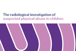 2017 09 26 18 43 7615 2017 09 27 Child Abuse Thumb