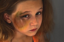 2017 09 28 18 48 0294 Abused Girl 400