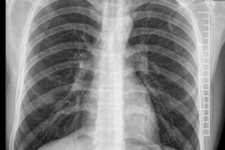 2017 10 02 19 17 6184 2017 10 03 Iran Thumb