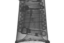 2017 10 02 23 37 6609 2017 10 03 Fraunhofer Box Valve Trumpet 400