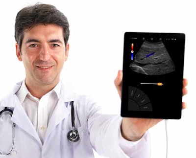 Sonoscanner's U-Lite EXP scanner. Image courtesy of Sonoscanner.