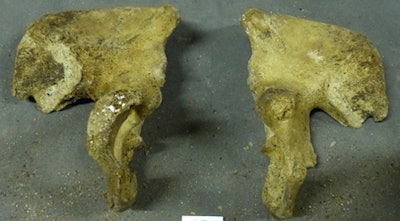 Photos show a 59-year-old male from St. Bride's, with osteoblastic lesions throughout the skeleton, suggestive of prostate cancer. All images and photos courtesy of Katherine van Schaik et al.