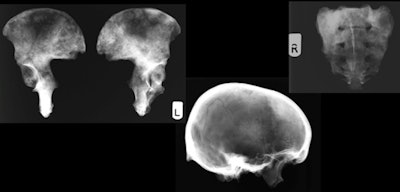 X-ray images of the 59-year-old male in the photos above.