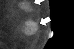 2017 10 11 16 24 5524 2017 10 12 Cesm Thumb