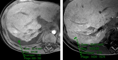 2017 10 12 18 11 7408 2017 10 13 Jfr Gad Pic1 500