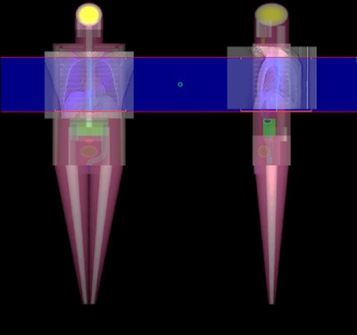 In her presentation today, Dr. Fides Schwartz outlined the principle of the dose tracking software used in her study.