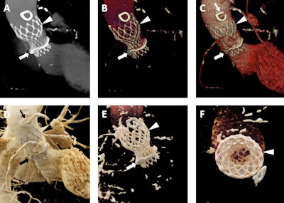 2017 10 20 18 27 8412 2017 10 23 Cr Fig4 400