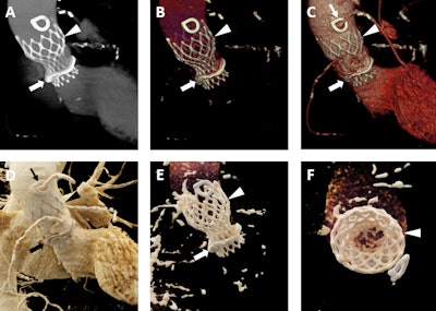 2017 10 20 18 27 8569 2017 10 23 Cr Fig4 700