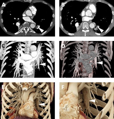 2017 10 20 18 27 9043 2017 10 23 Cr Fig5 400