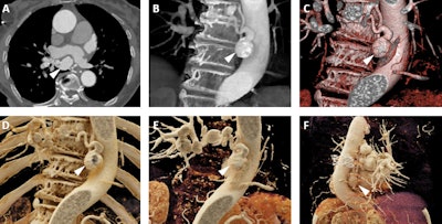 2017 10 20 18 28 0287 2017 10 23 Cr Fig9 865