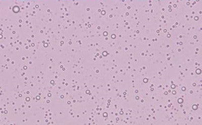 Microbubble ultrasound contrast agents under the microscope.