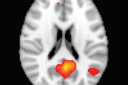 2017 10 18 23 22 5769 Mr Cardiac Arrest Stevens 400