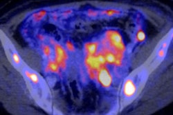 2017 11 02 15 35 9363 2016 03 29 Pet Ct Pet Image Thumb2