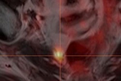 2017 11 02 18 40 3071 2017 11 02 Psma Pet Ejnmmi Images 20171102190314