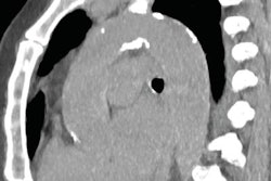 2017 11 07 19 06 0926 2017 11 08 Ct Messerli Figure 3 20171107194754