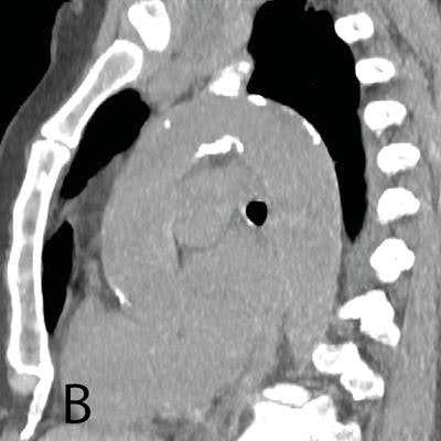 2017 11 07 19 06 0926 2017 11 08 Ct Messerli Figure 3 20171107194754